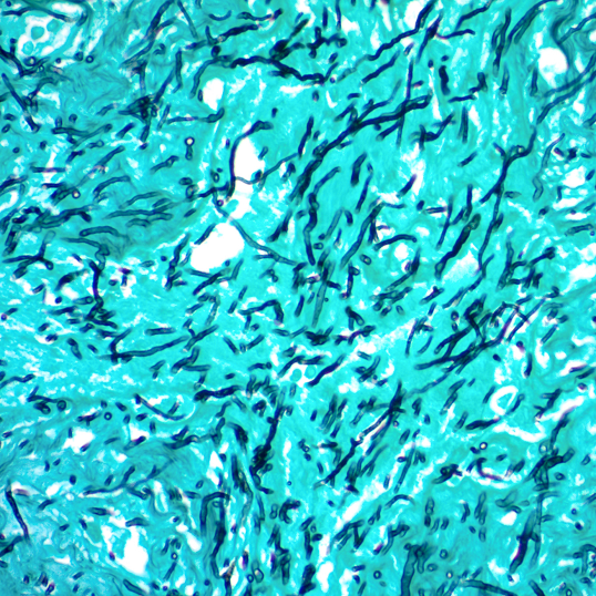 GMS Stain Kit